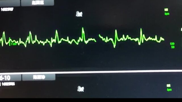 Various graphics and data on the monitor