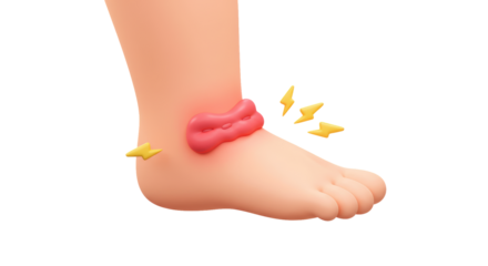 Isolated Injured Foot