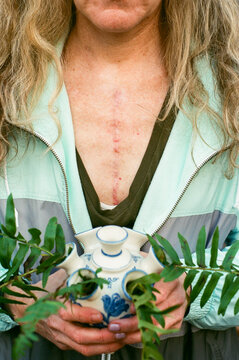 Woman with Heart Surgery Scar