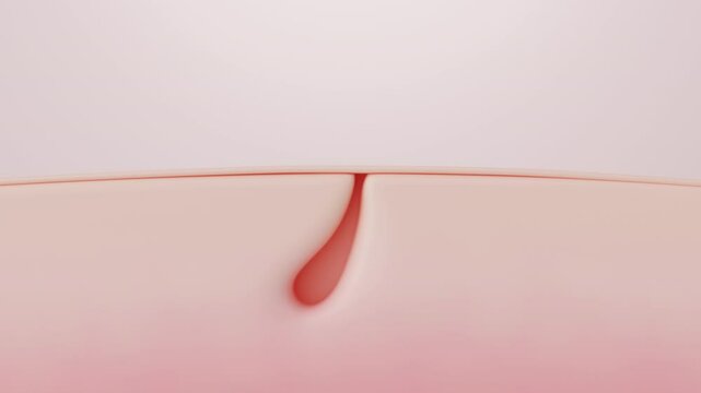 Acne Treatment with Pore Tightening Effect