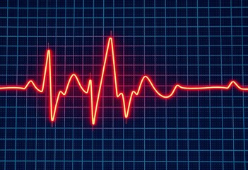 Close-up of EKG showing irregular heartbeat during a heart attack,  ICU,  vital signs