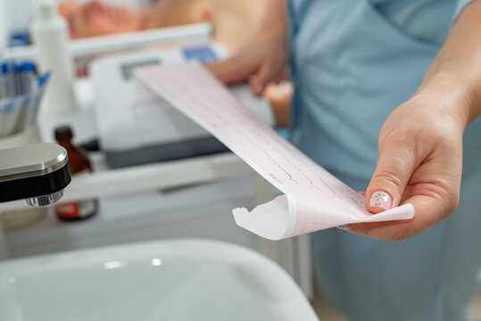 Doctor taking a cardiogram from a faceless patient in a hospital - Powered by Adobe