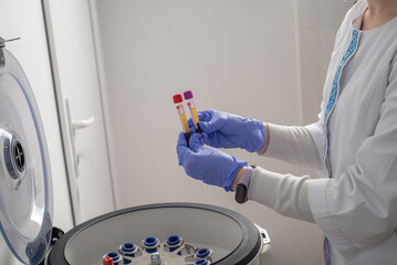 Nurse places test tubes with blood for analysis into a centrifuge