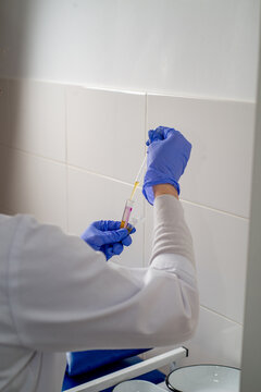 Split in a plasma and blood test tube in the hands of a medical worker