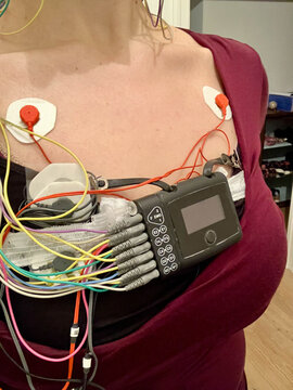 UGC Selfie with sleep monitoring machine on
