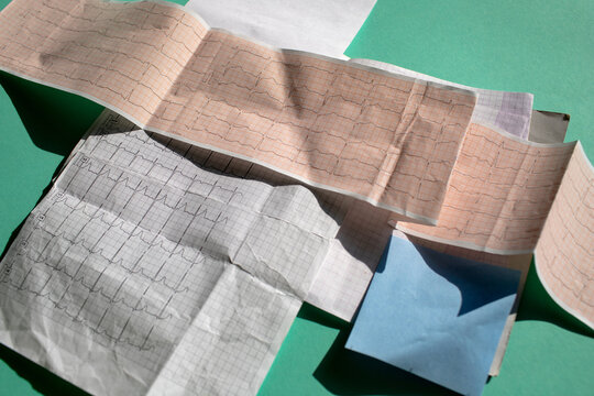 printed cardiogram