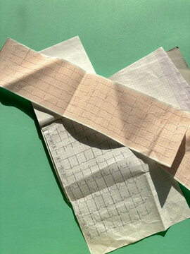 printed cardiogram