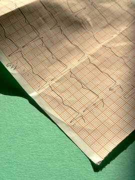printed cardiogram