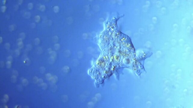 Amoeba motility observed under DIC microscope in freshwater lake-400x magnification
