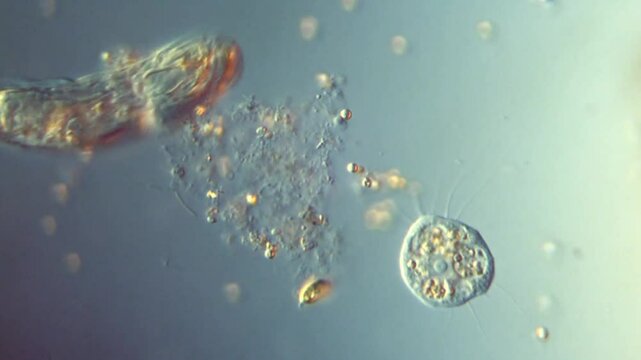 Freshwater eukaryotic microorganisms protozoa rotifer bacteria - 400x magnification DIC microscope