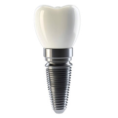 Model of a dental implant with a dental crown and a metal screw component on a white or transparent background