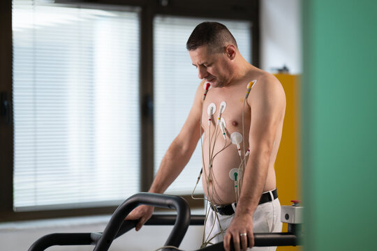 A middle-aged man is undergoing a medical stress test on a treadmill, connected to ECG electrodes for heart monitoring in a clinical environment