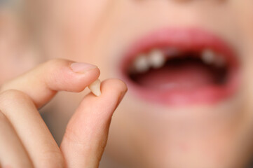 Child holding fallen baby tooth in hand against background of mouth with smile with missing teeth,...