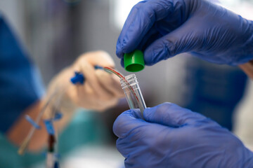 Scientist placing blood sample into test tube during medical research experiment