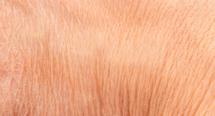 Fototapeta premium Macro texture of dry human skin, flaky epidermis closeup view, wrinkled body skin rough detail