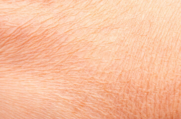 Macro texture of dry human skin, flaky epidermis closeup view, wrinkled body skin rough detail