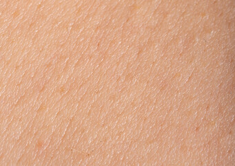 Macro texture of human skin, closeup view of healthy body skin, rough epidermis detail surface