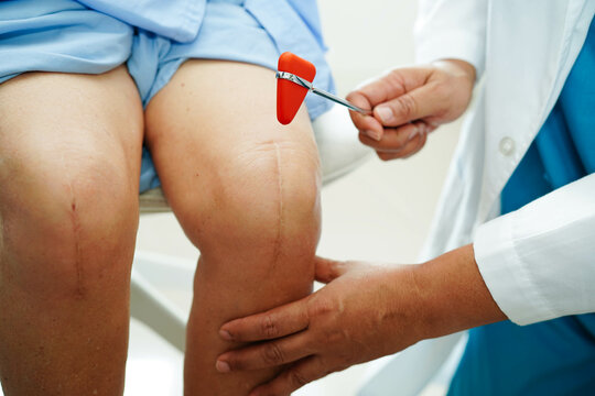 Asian doctor knock on knee reflex nerve for check and treatment senior patient in hospital.