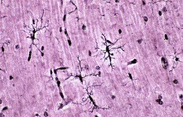 Microglia cells. Rio-Hortega’s silver carbonate