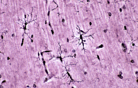 Microglia cells. Rio-Hortega&rsquo;s silver carbonate