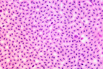 Bird blood. Nucleated red blood cells