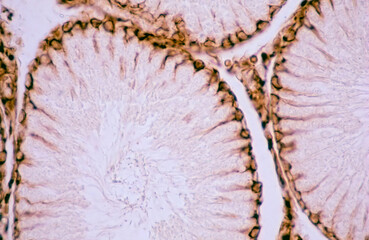 Sertoli cells. Vimentin immunostaining
