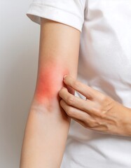 Close-up of irritated skin being scratched by a fair-skinned hand, showing symptoms of skin sensitivity or dermatitis