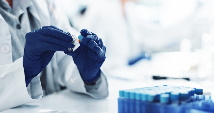 Scientist, hands and gloves with blood sample or label for DNA test, exam or medical discovery at laboratory. Closeup, person or research with vitals for clinic results, analysis or cure at lab