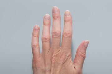 A detailed close-up of an elderly person's hand with visible wrinkles and veins on a white...