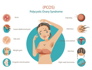 Polycystic Ovary Syndrome Symptoms