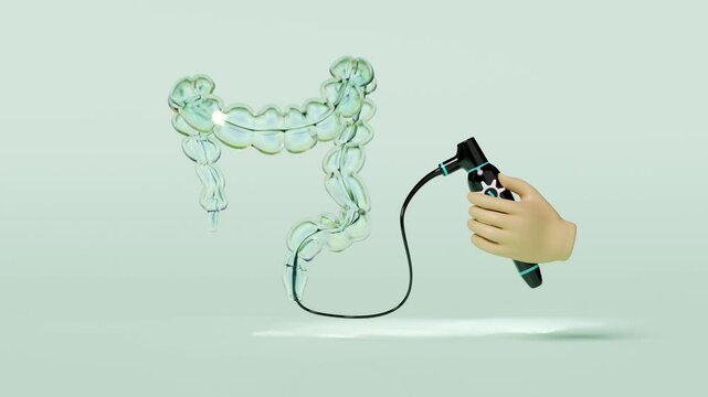 Colonoscopy to find the cause of disease isolated on green background. check digestive, intestine health concept, 3d illustration render, alpha channel