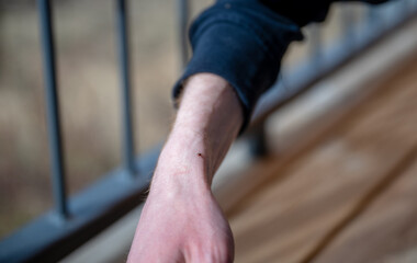 tick walking on the hand. It is a dangerous arachnid that is a carrier of many pathogens