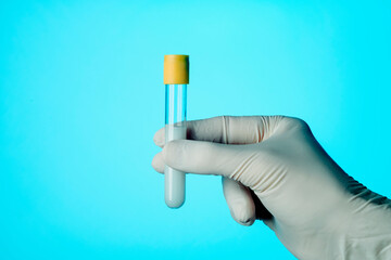 man holds a test tube with some semen