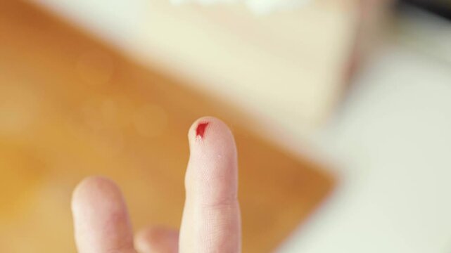 Close-up of a man's  finger cut in blood with a kitchen knife on a background. Injured finger with bleeding open cut wound.