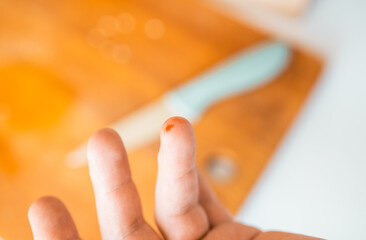 Close-up of a man's  finger cut in blood with a kitchen knife on a background. Injured finger with...