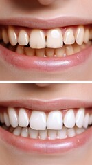 Detailed view of teeth showcasing before and after dental work, emphasizing transformation in color and alignment effectiveness