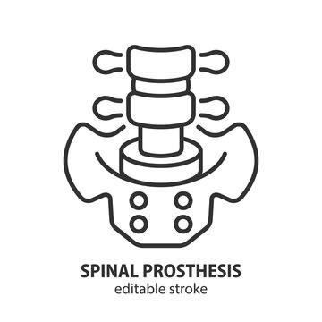 Spinal prosthesis line icon. Replacement disc symbol. Arthroplasty vector illustration.Editable stroke.