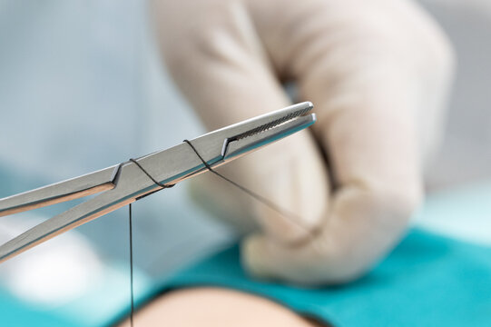 Doctor hand wear sterile gloves and surgery scissor stitching up wound after surgery.Plastic surgeon placing sutures after plastic surgery in operating room.Nurse teaches the technique of suturing.