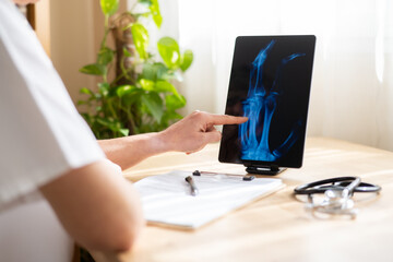 Doctor pointing at a digital tablet displaying a hand x-ray, conducting a medical consultation and...