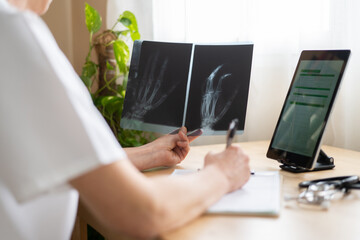 Traumatologist analyzing radiography of hand bones, writing medical report on notepad, using...