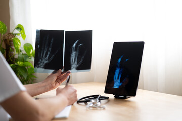 Doctor holding and examining hand x-rays, comparing them with digital image on tablet, taking notes...