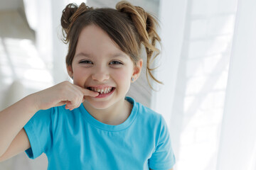 Loss baby teeth. Baby teeth have to fall out to make way for permanent teeth to grow. Girl showing...