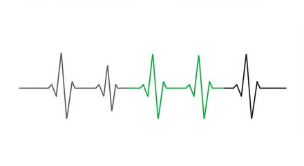 Heartbeat or ekg line illustration with grey, black and green colors for medical website banner, application background and emergency service greeting card or flyer