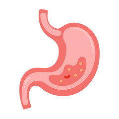 A stomach