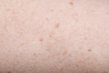 Fototapeta premium Texture of healthy skin as background, closeup