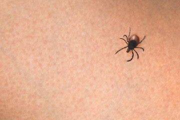 Tick on the skin, close up, copy space
