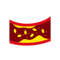 Artery with cholesterol plaque buildup vector illustration 