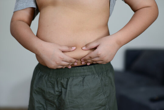A fat child with a fat belly holds his stomach with his hands.