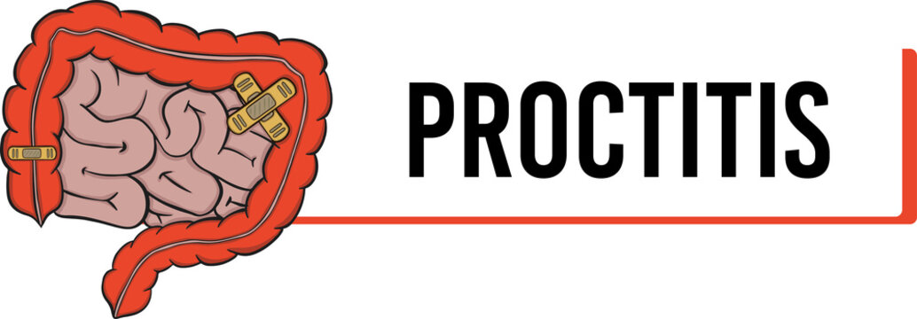 proctitis