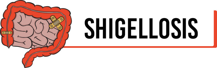 shigellosis